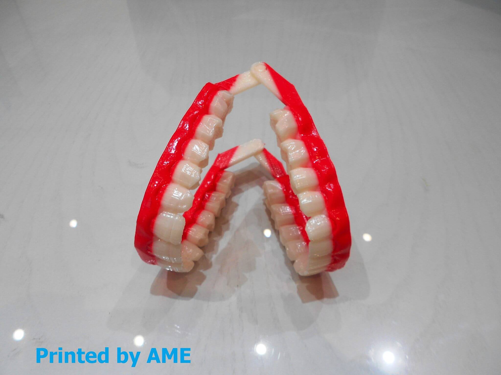impression 3d prothèse dentaire